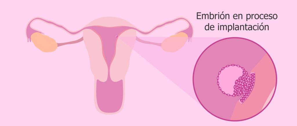test de receptividad endometrial