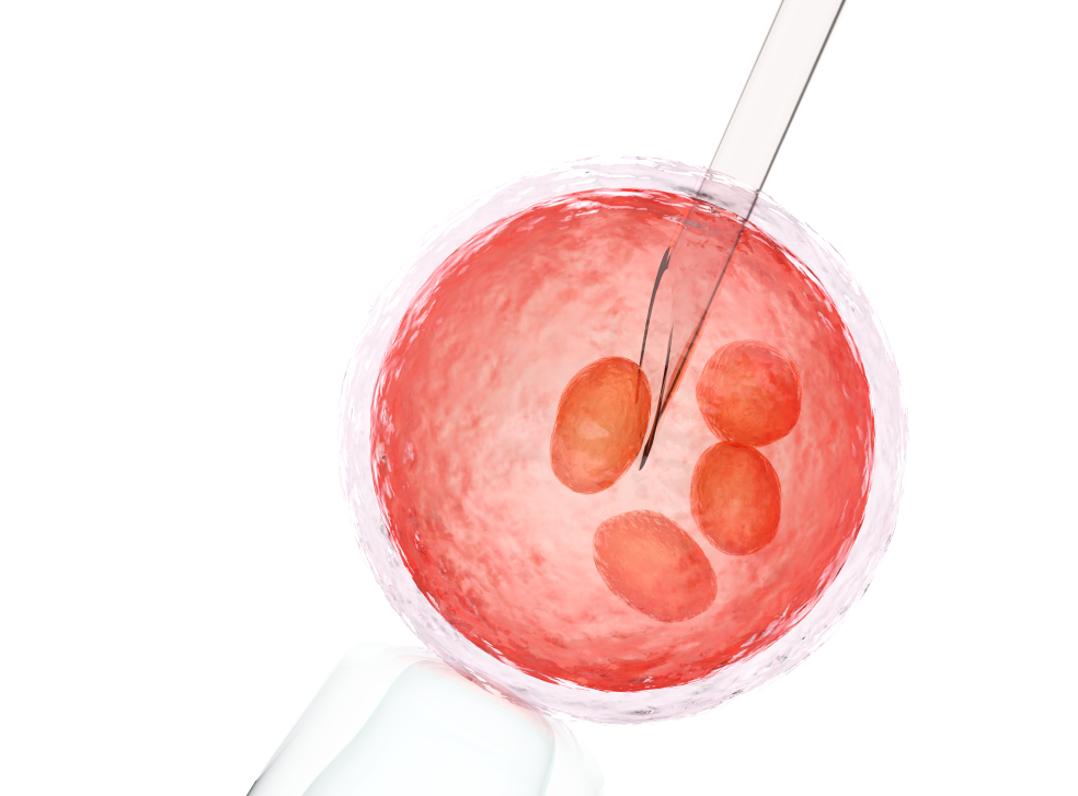 ovum with needle artificial insemination vitro fertilization